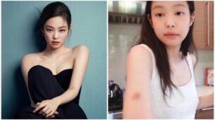 Jennie From Blackpink Got A Bruise In An Unpredictable Way, Find Out
