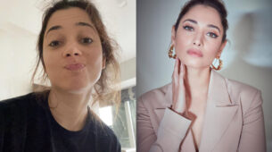 How To Get Rid Of Pimples ? Tamannaah Bhatia Knows The Answer