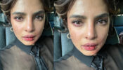 OMG: Priyanka Chopra is injured on sets, see shocking blood-smeared face and bruises