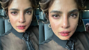 OMG: Priyanka Chopra is injured on sets, see shocking blood-smeared face and bruises
