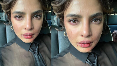 OMG: Priyanka Chopra is injured on sets, see shocking blood-smeared face and bruises