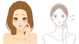 Types Of Dark Circles: Use Facial Massages To Remove Them