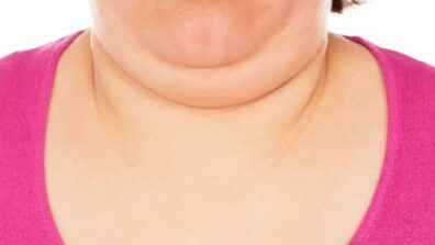 Get Rid Of That Double Chin Today: Try These Facial Exercises