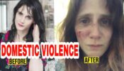 Shocking: French actress Judith Chemla becomes victim of domestic abuse, shares photos of bruised face not heartbreaking note