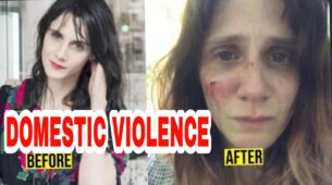 Shocking: French actress Judith Chemla becomes victim of domestic abuse, shares photos of bruised face not heartbreaking note