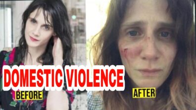 Shocking: French actress Judith Chemla becomes victim of domestic abuse, shares photos of bruised face not heartbreaking note