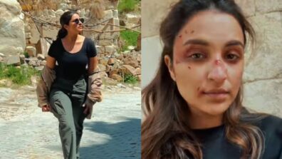 Aur Bano Action Heroine: Parineeti Chopra shows off her bruises ahead of shoot, netizens feel inspired