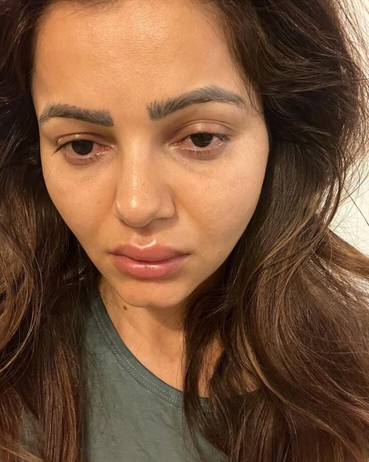 Rubina Dilaik shares her swollen face picture, fans get worried 770803
