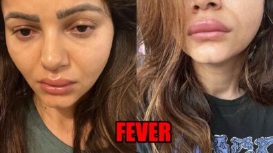 Rubina Dilaik shares her swollen face picture, fans get worried