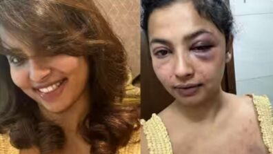 Malayalam actor Anicka Vikhraman accused ex-boyfriend of abuse, see shocking snaps of bruises