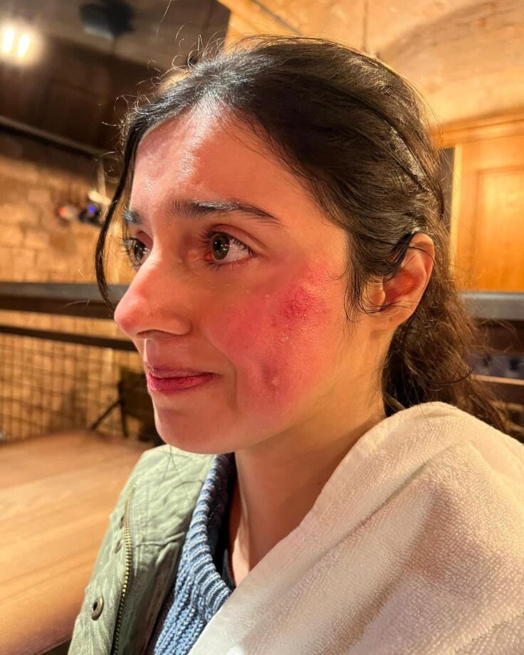 OMG: Divya Khosla Kumar gets injured while shooting action sequence 785509