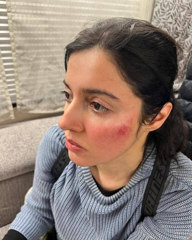 OMG: Divya Khosla Kumar gets injured while shooting action sequence 785510