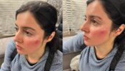 OMG: Divya Khosla Kumar gets injured while shooting action sequence