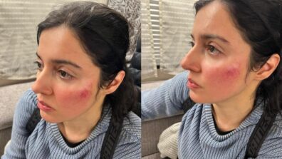 OMG: Divya Khosla Kumar gets injured while shooting action sequence