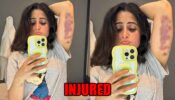 Khatron Ke Khiladi 13 contestant Aishwarya Sharma gets badly injured, shares photo of her bruises