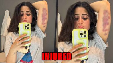 Khatron Ke Khiladi 13 contestant Aishwarya Sharma gets badly injured, shares photo of her bruises