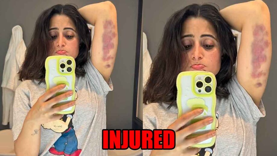 Khatron Ke Khiladi 13 contestant Aishwarya Sharma gets badly injured, shares photo of her bruises 809004