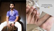 Siddharth Nigam gets severe injuries at his recent football match